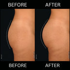 Selenek EMS Toning Shorts