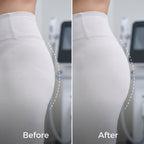 Selenek EMS Toning Shorts