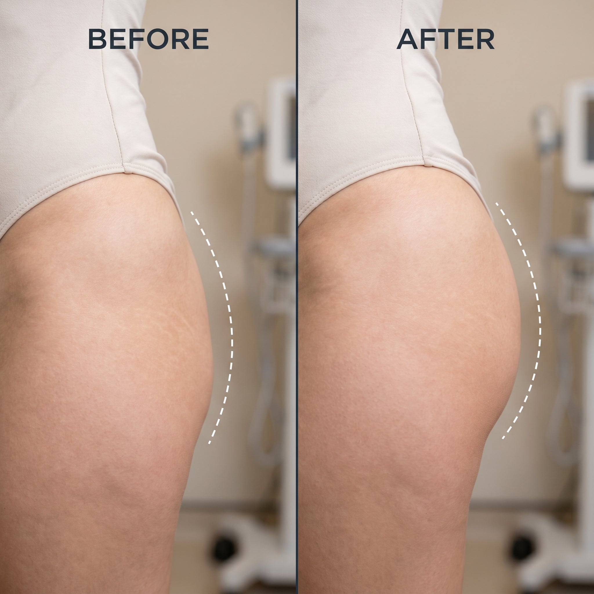 Selenek EMS Toning Shorts