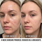 Selenek Wireless 4-in-1 LED Light Therapy Face Mask