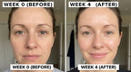 Selenek Wireless 4-in-1 LED Light Therapy Face Mask